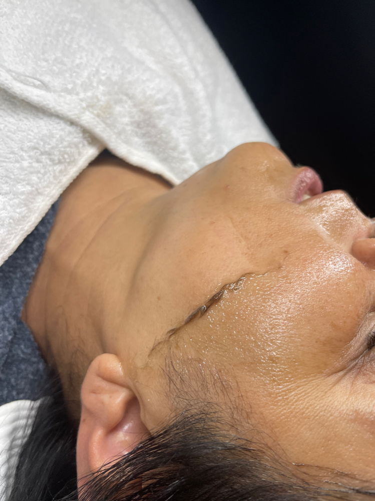 Dermaplane Express Treatment