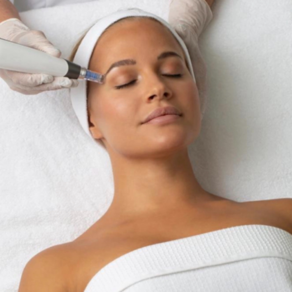 RF Microneedling — Décolleté at Sunshine Esthetics Lounge in Lake Mary, FL