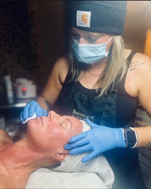 Chemical Peel
