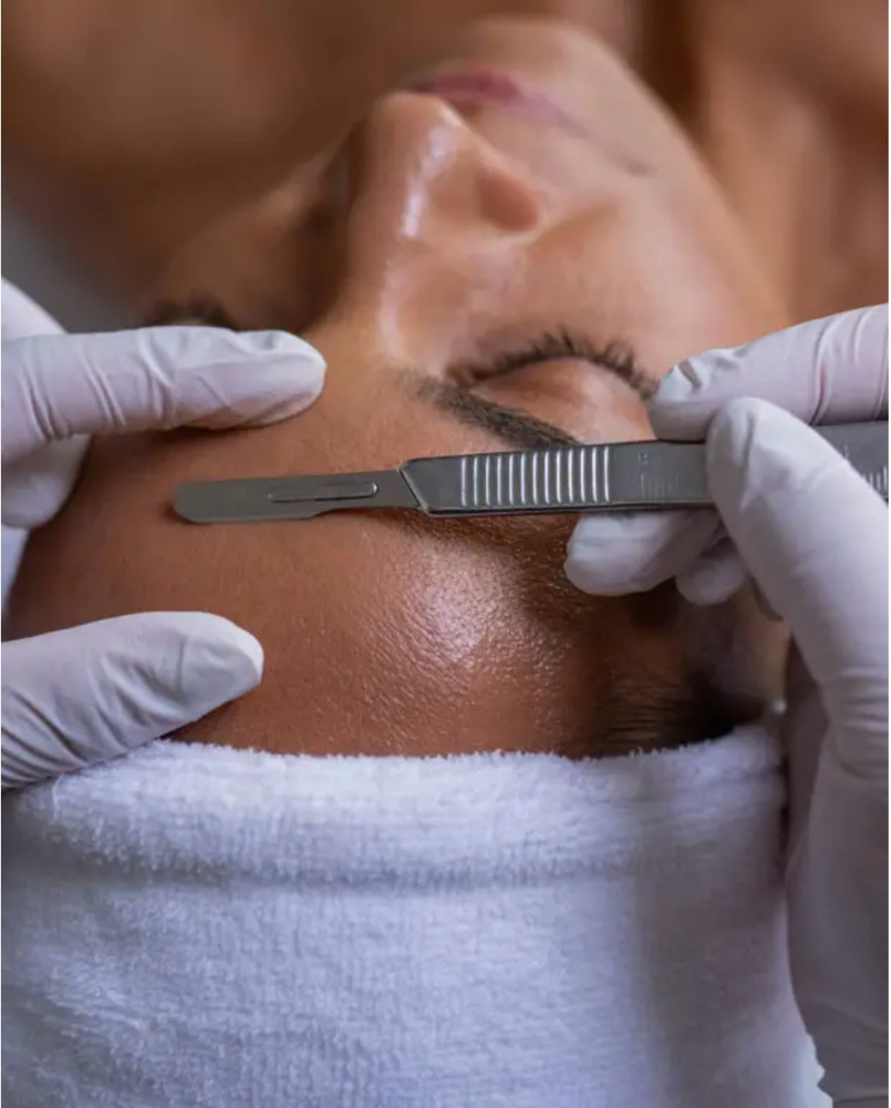 Dermaplaning at RM Asthetics Spa in Boston, MA