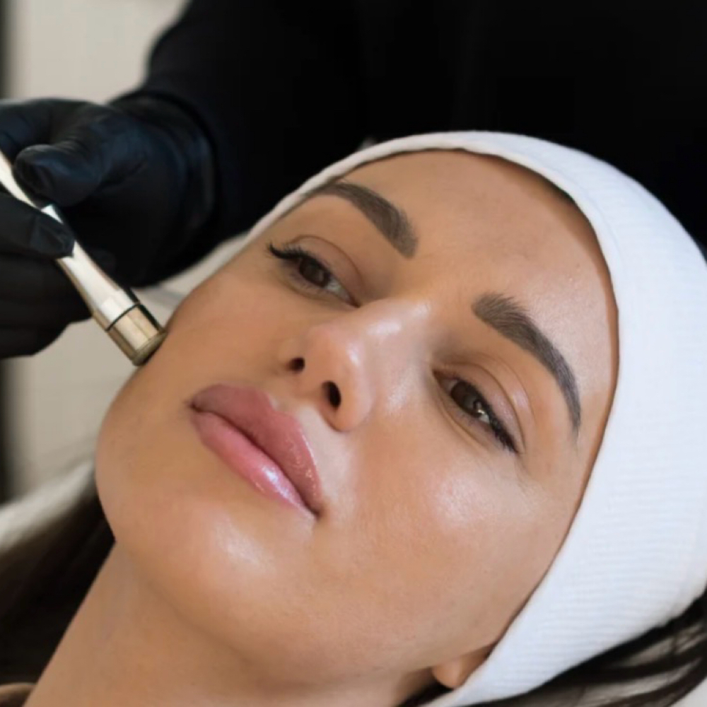 Microdermabrasion at Rustic Sage Beauty Esthetics By Christie in Acton, TX