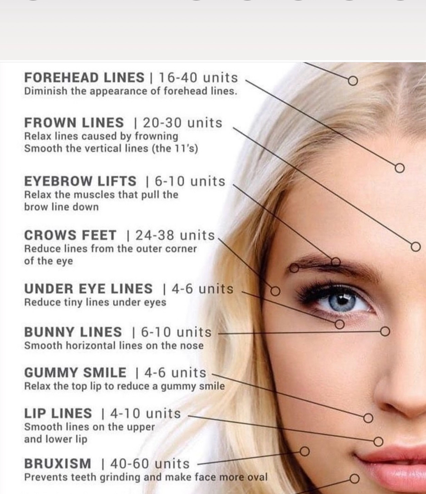 11 Lines Treatment (neurotoxin)