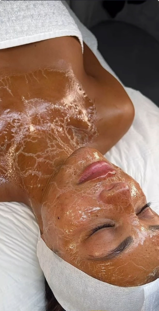 Beyond Botox Facial