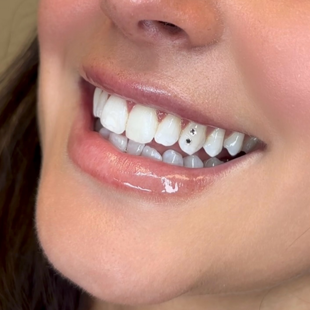 Double Stack — Balanced Glow at Luna Smiles in Lexington, SC