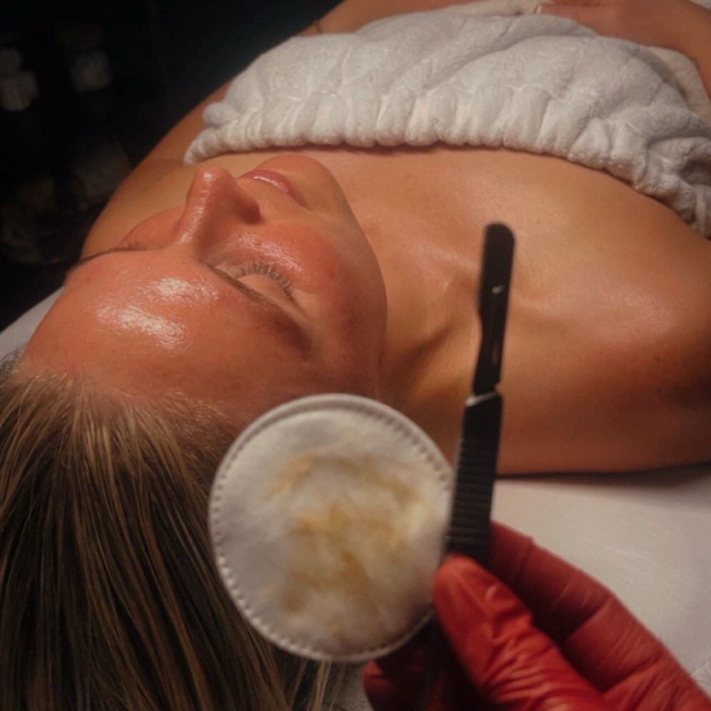 The Dermaplane Mini Facial at SkinLab Esthetics in Paragould AR, AR
