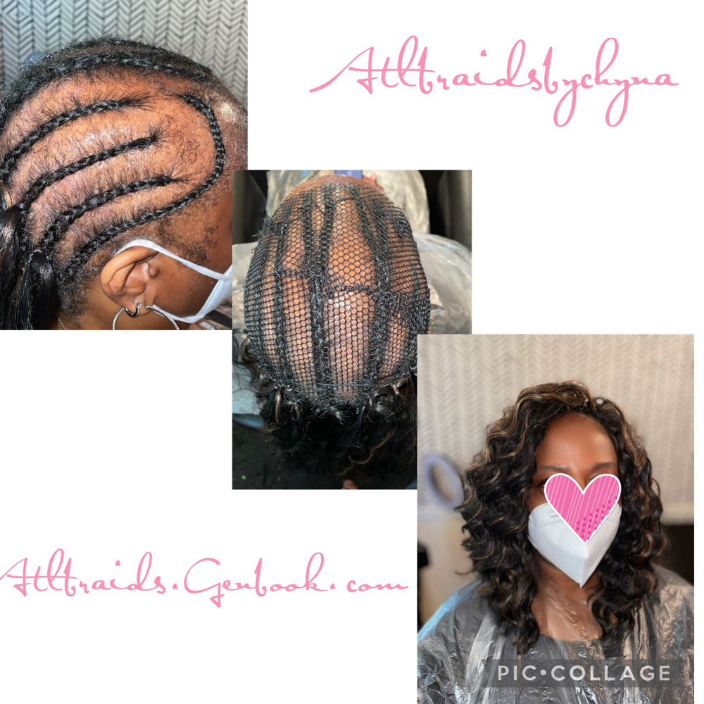 Alopecia/thinning Area Net