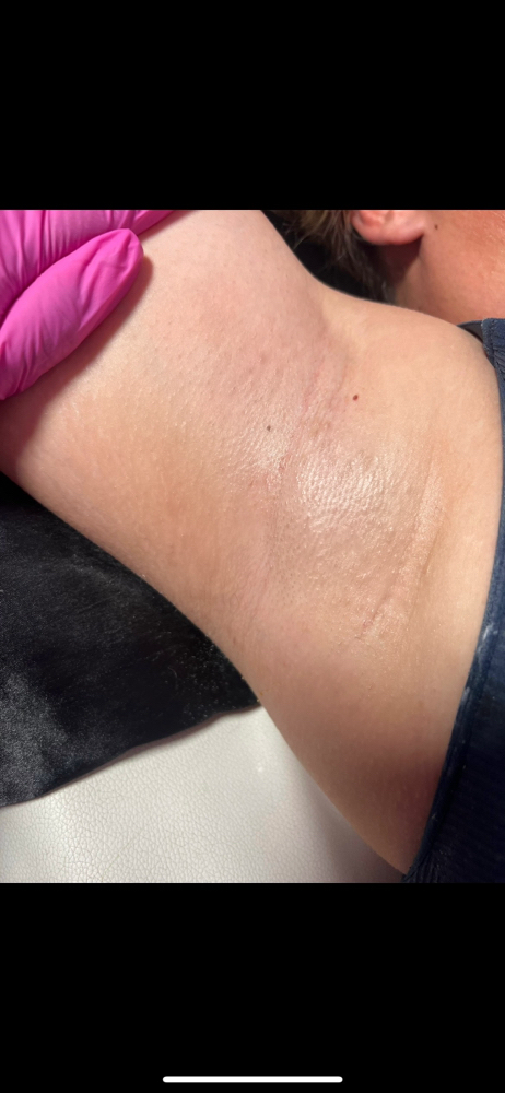 Under Arm Sugar Wax at Karinaglamz in San Jose, CA