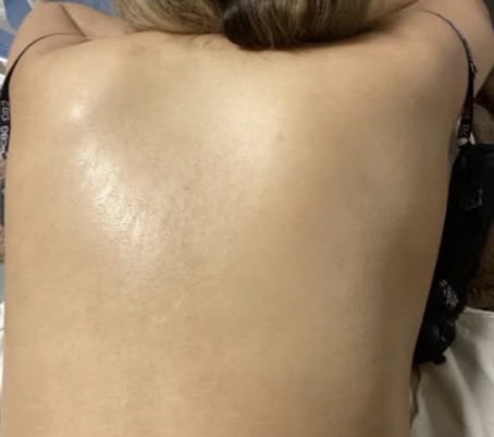 Back Treatment