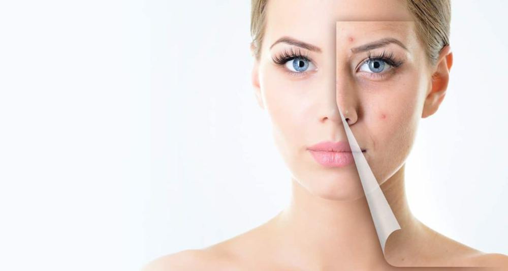 Lightening Lift Peel