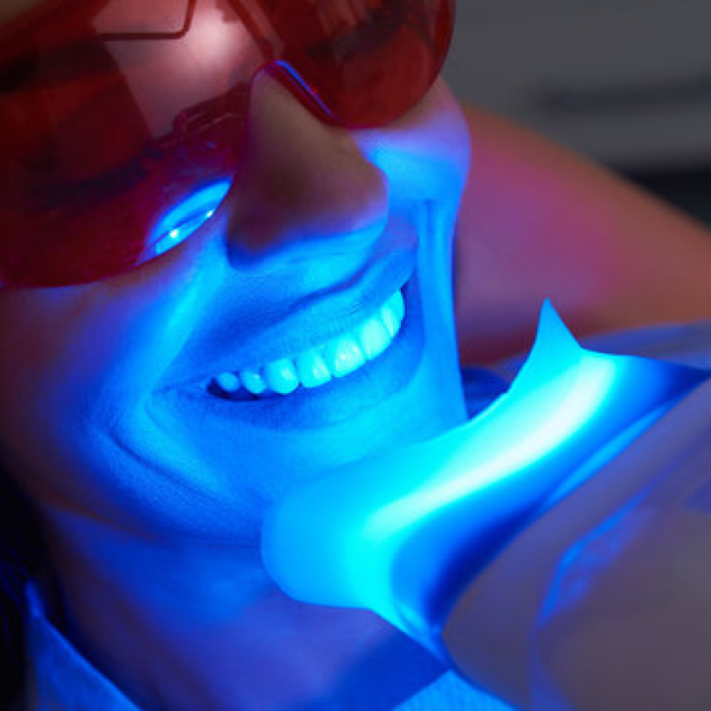 Teeth Whitening at GLOvana Lash Studio in Frisco, TX