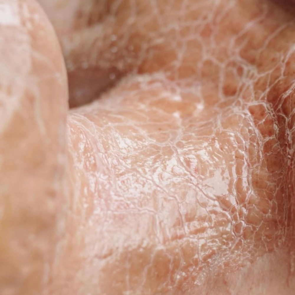 Natural “Botox” Facal