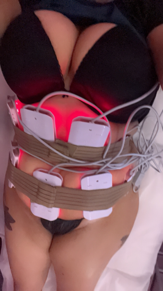 Laser Lipo And Cellulite Transfer