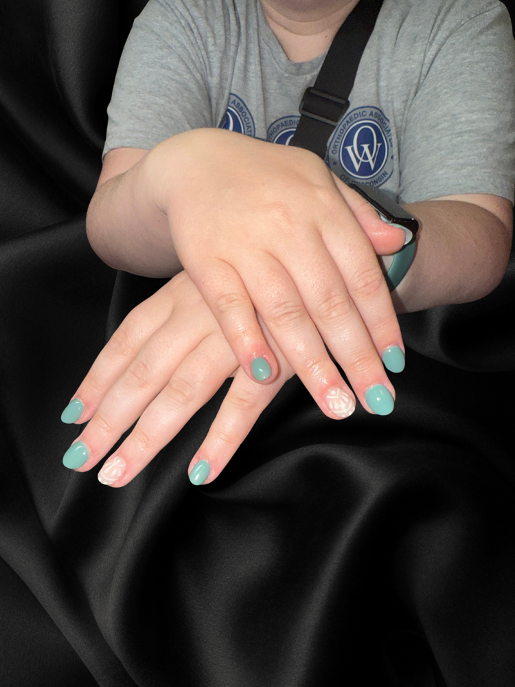 Acrylic Fill at Onyx No. 22 in Johnson Creek, WI