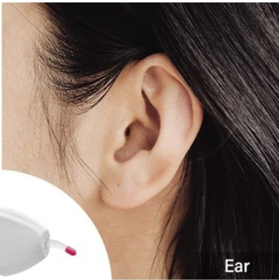 Ears -Laser Hair Removal