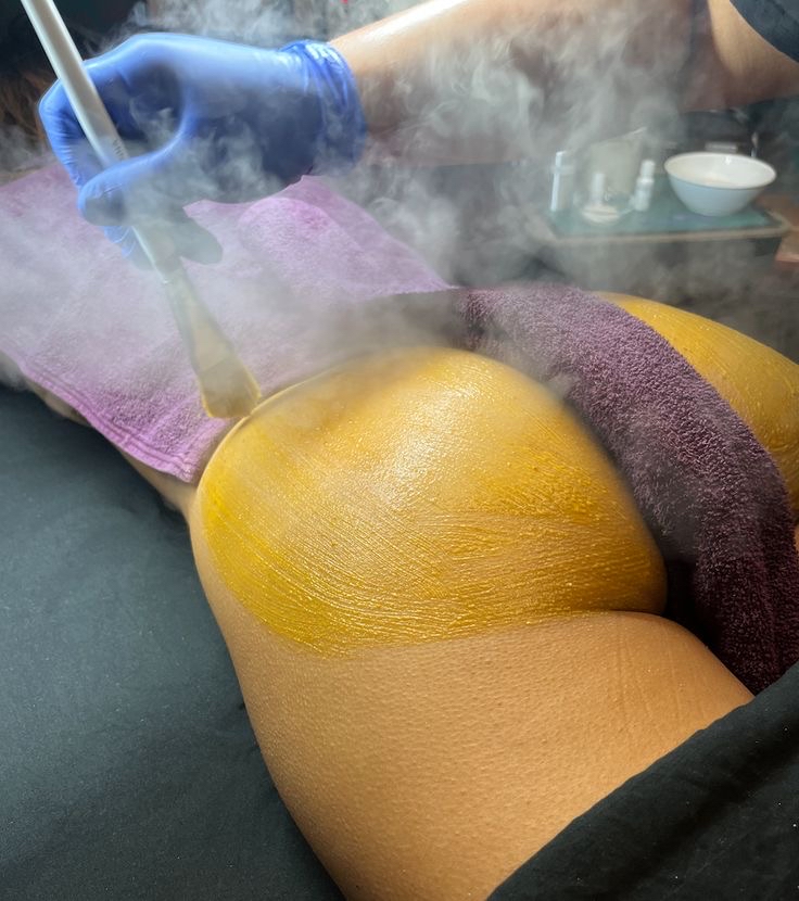Bum Bum Facial 🍑 at Des Beauty & Skin in El Paso, TX