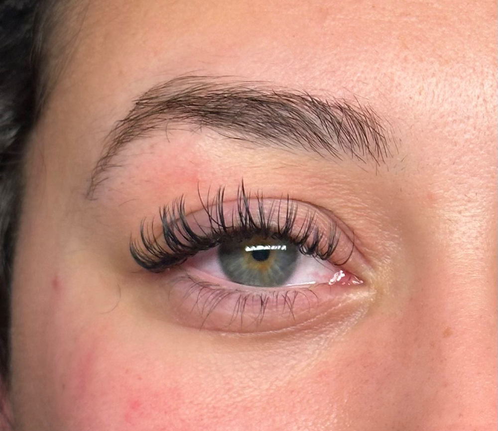 ANGEL SET 3 Week Fill (15 Days +)