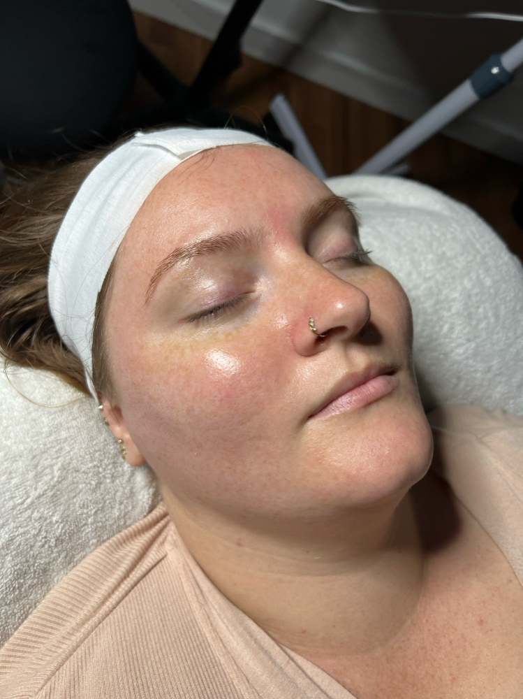 Dermaplaning Facial