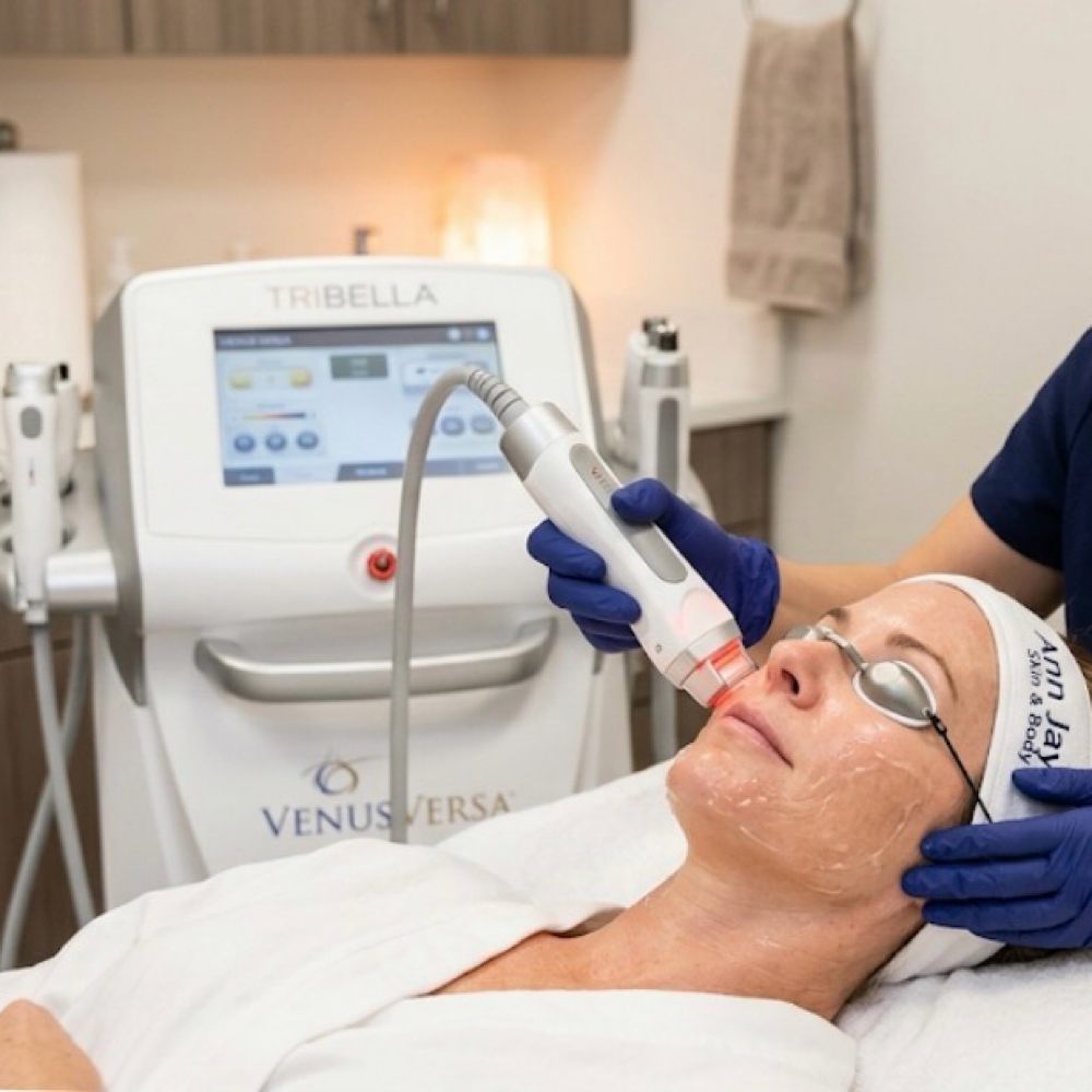 TRIBELLA Total Facial Rejuvenation at Ann Jay Skin & Body in Clifton, NJ