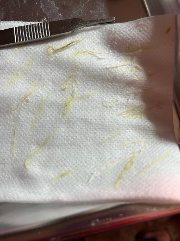 Dermaplaning