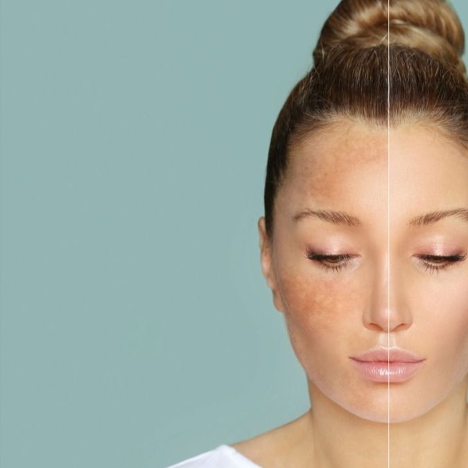Brighten & Correct Pigment Facial at AGELESS SKIN BY ASEEL MED SPA in Prosper, TX
