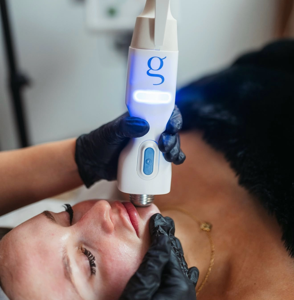 Advanced Clear Skin Acne Treatment at VOGUE AESTHETICS in Okeechobee, FL