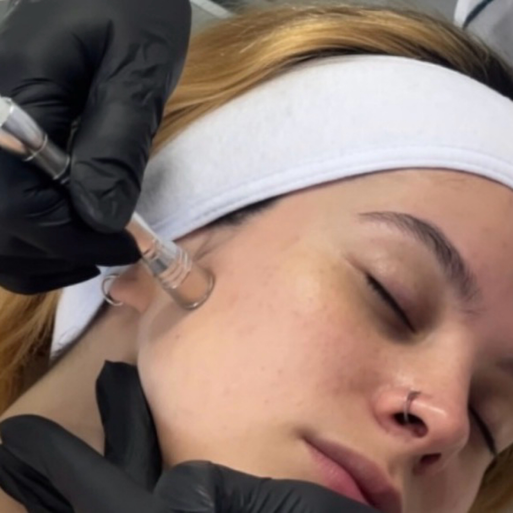 80 Min Microderm Facial at My Favorite Spa in North Carolina, NC