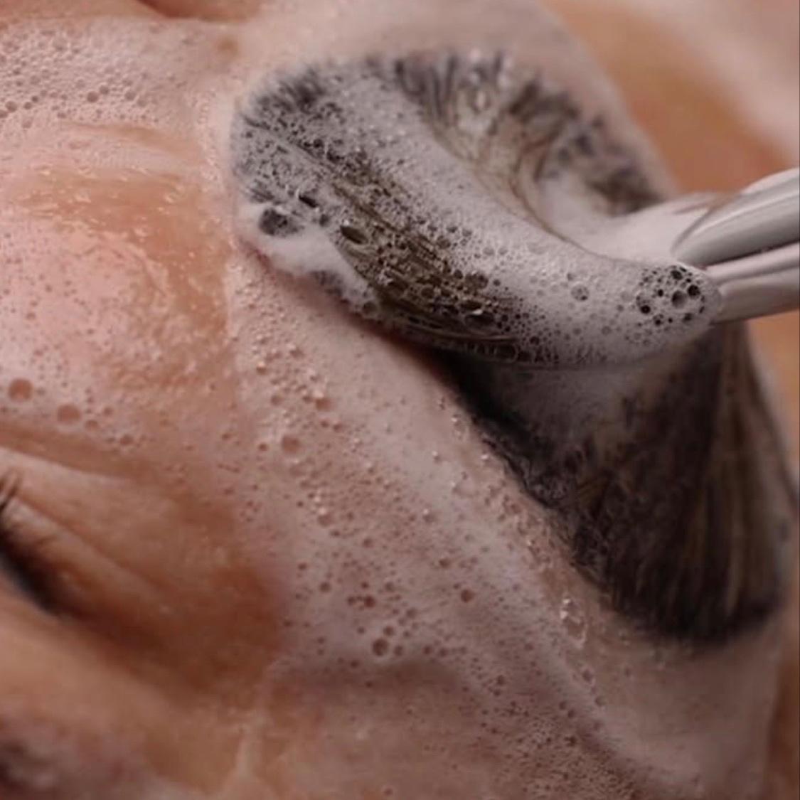Barrier Reset Recovery at Cara Bella Aesthetics in Temecula, CA