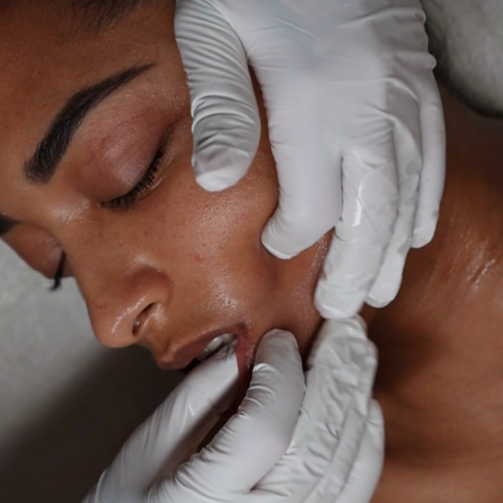 Buccal Reset at Floetouch in San Diego, CA