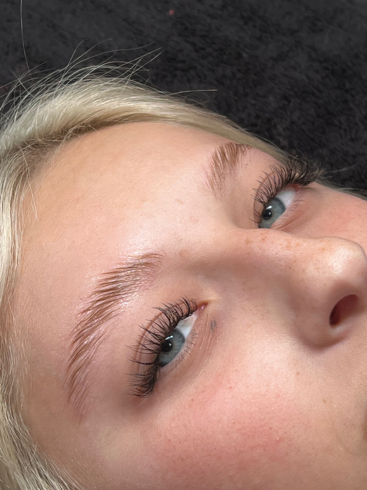 Brow Lamantion