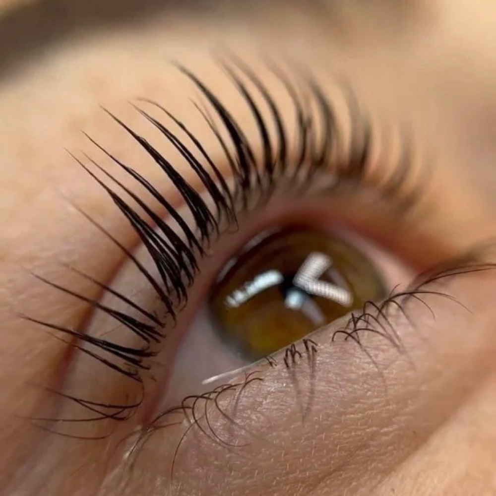The RealEyes Elevate at RealEyes Aesthetics in Los Angeles, CA