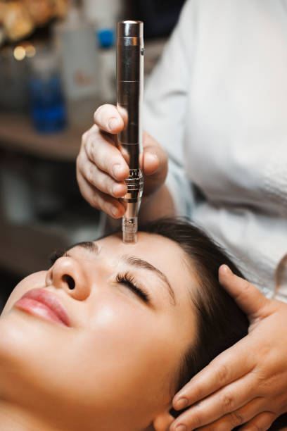 MICRONEEDLING
