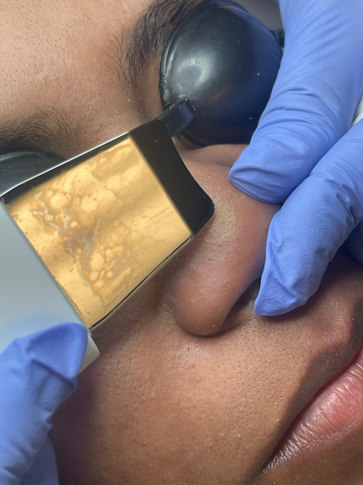 Deep Facial