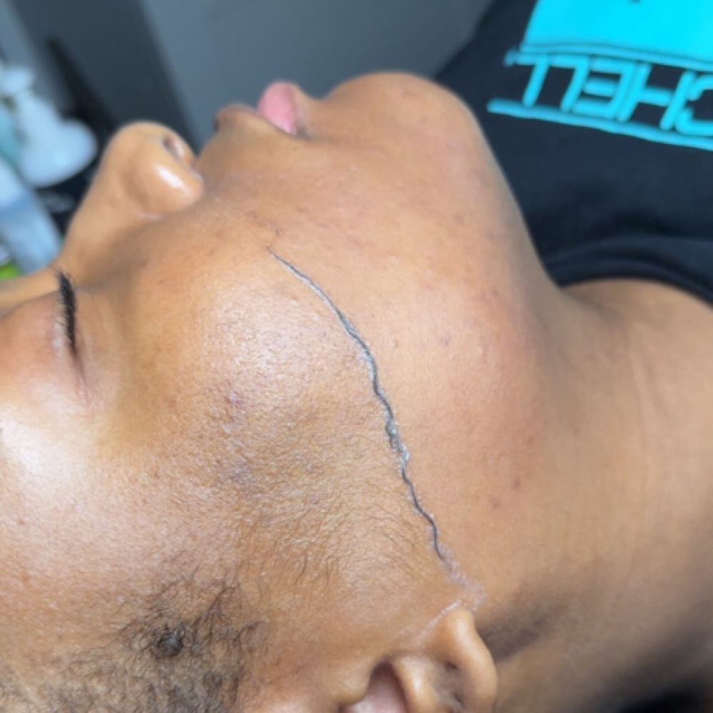 Dermaplane Add On at Luxe Beauty Aesthetics in Loganville, GA