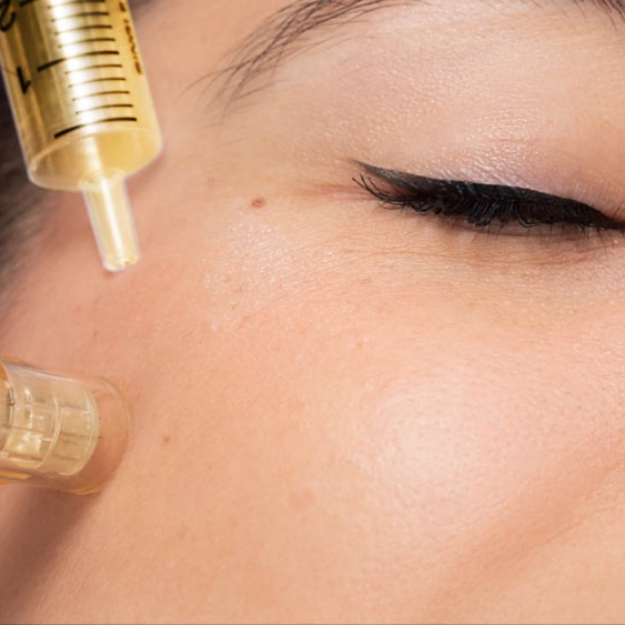 PDRN Nanoinfusion Facial at Arcana Med Spa in Castle Rock, CO