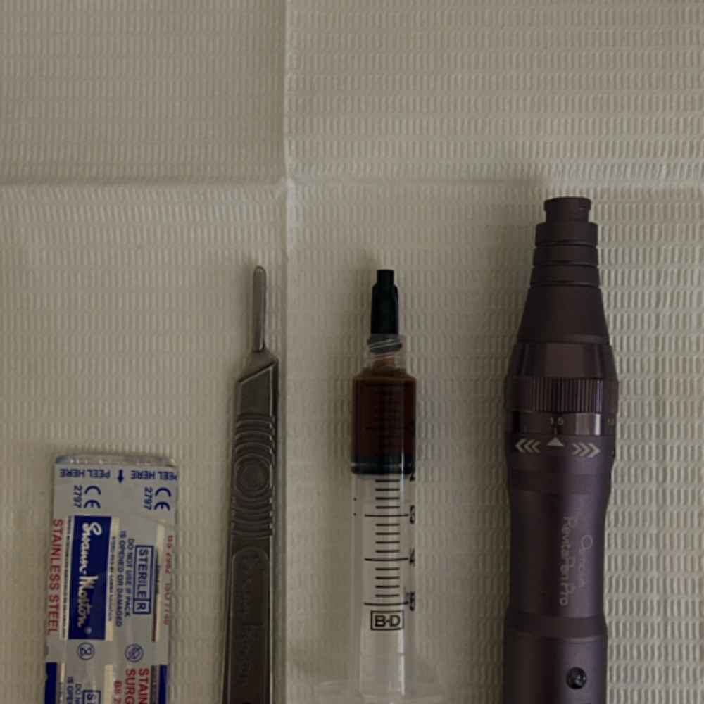 Nano Infusion Treatment at Fresh Till Death Esthetics in Beacon, NY