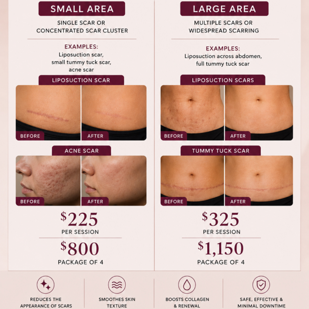 PRX C Large Area Scar Treatment at Pattyb Wellness in Bellmore, NY