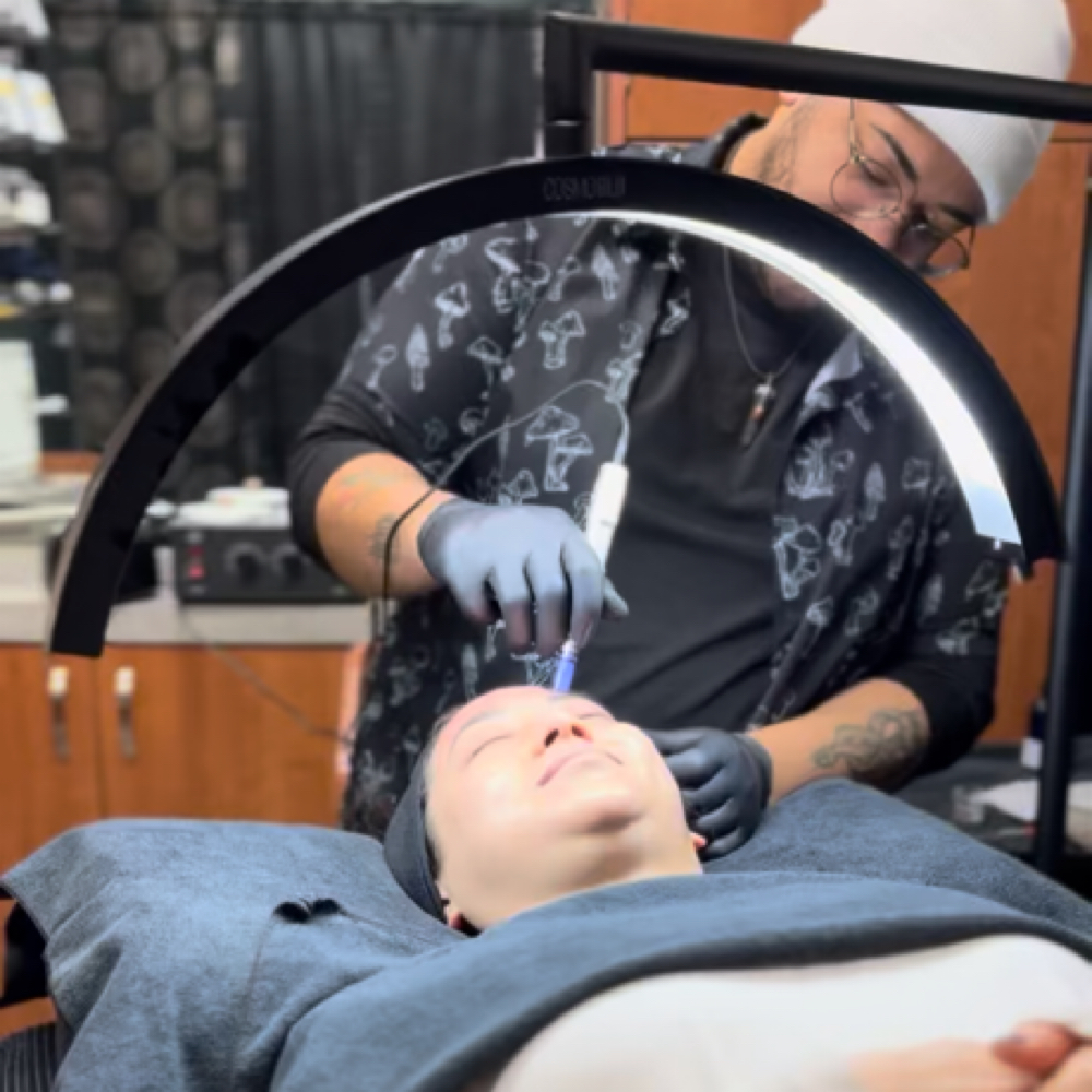 Microneedling at Face by Isaac in Austin, TX