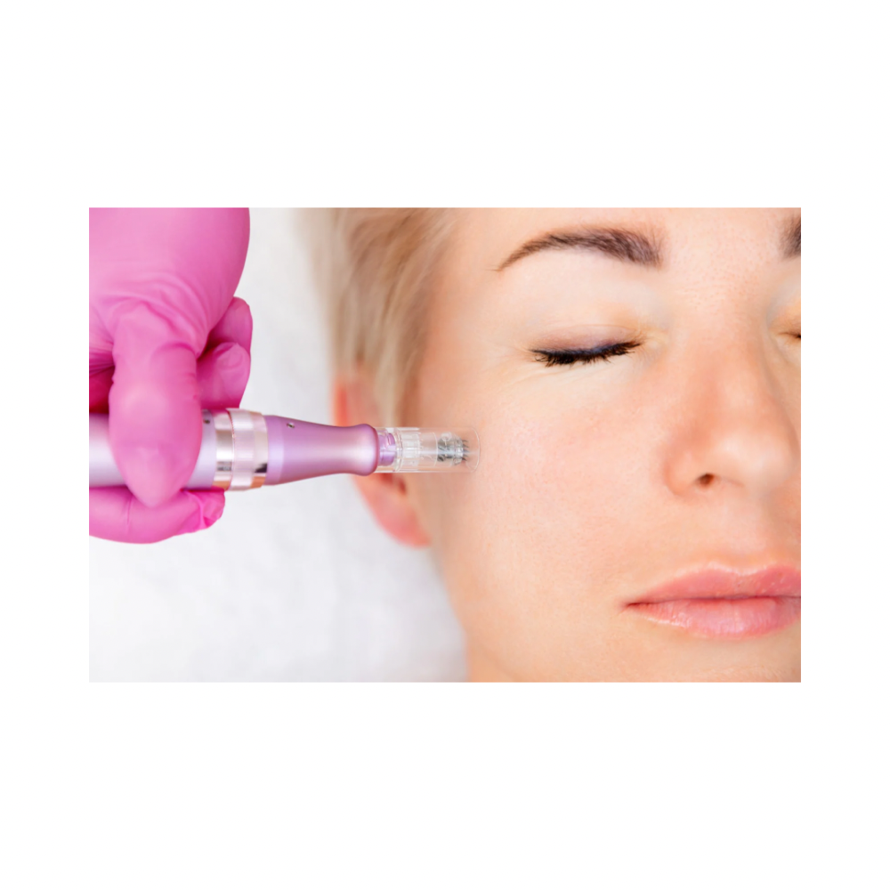 Dermapen Microneedling