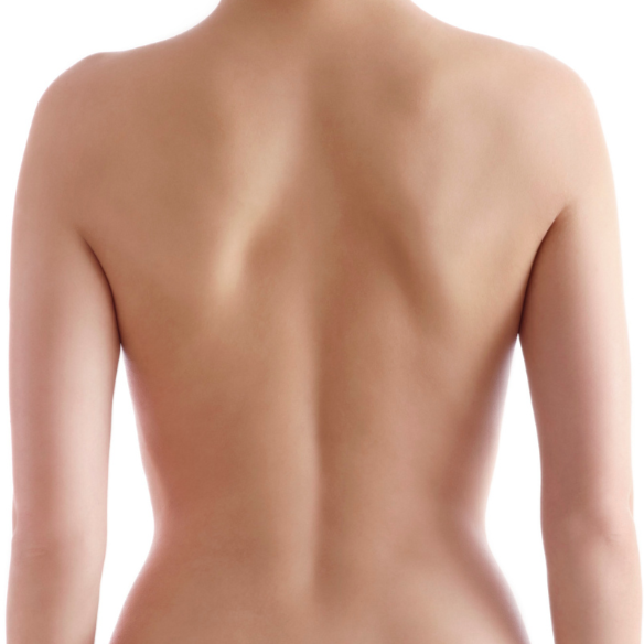 Back Full at Bareline Aesthetics in Brea, CA