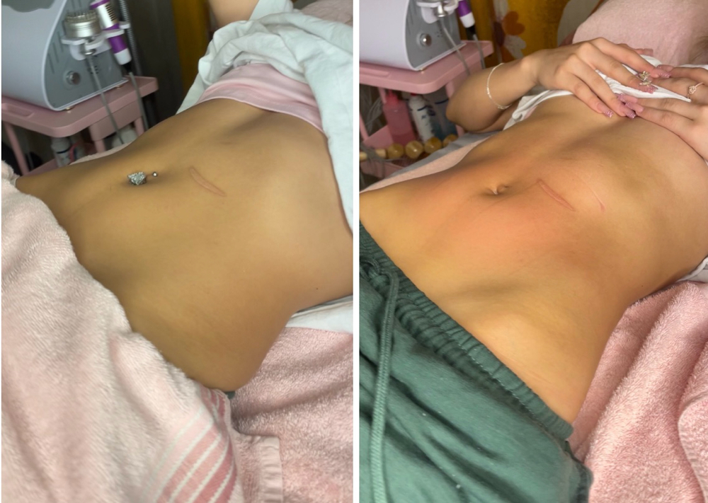 Sculpted 5 In 1 at Sculpted by Lluvia in Weslaco, TX