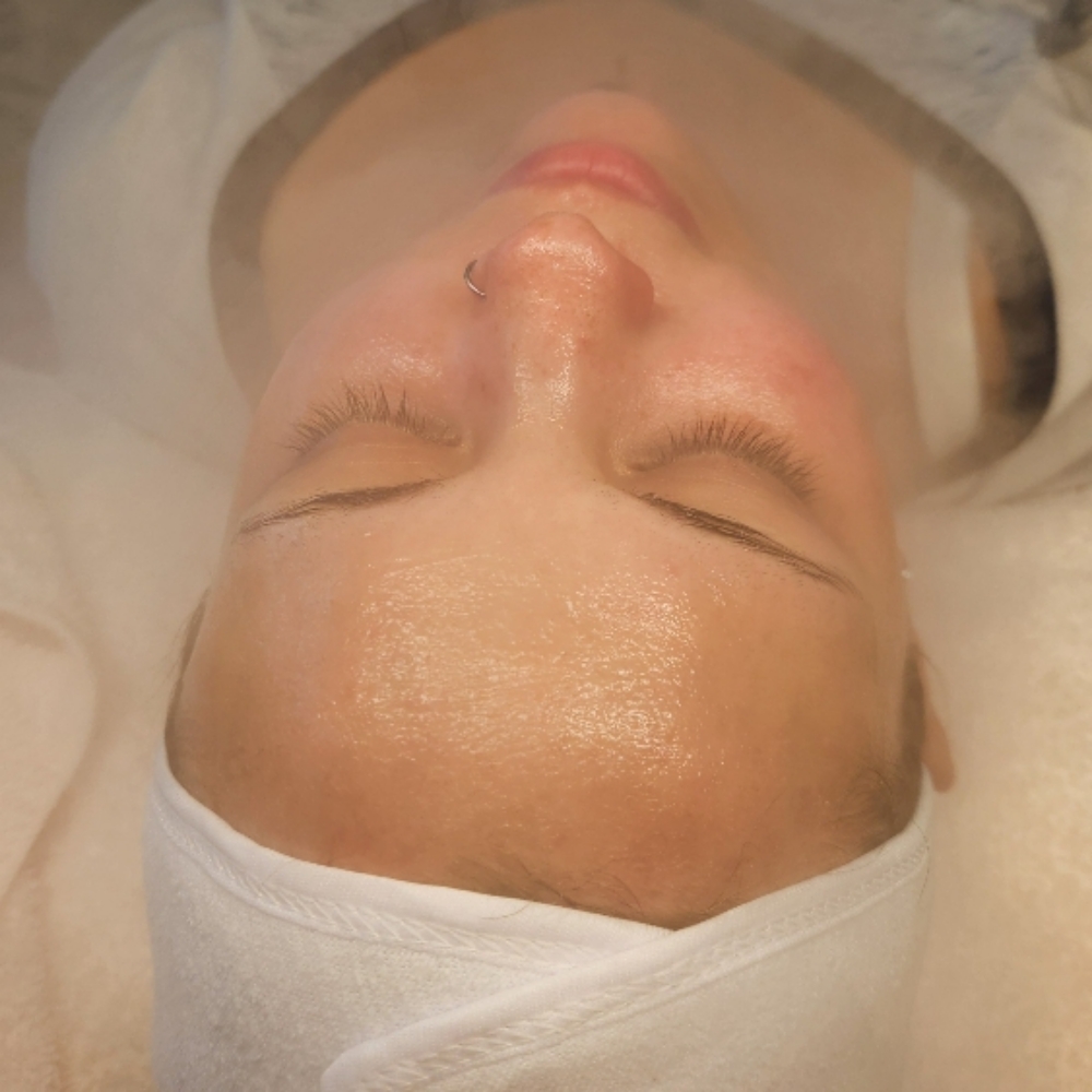 🫧Clear Skin Teen Acne Reset 🍑 at C|E Esthetics in Moore, OK