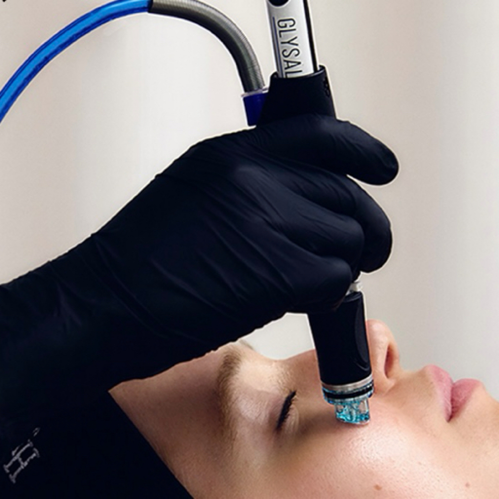 Platinum HydraNeedling at TENEYCK AESTHETICS in Overland Park, KS
