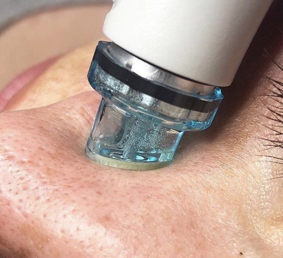 Hydro Facial