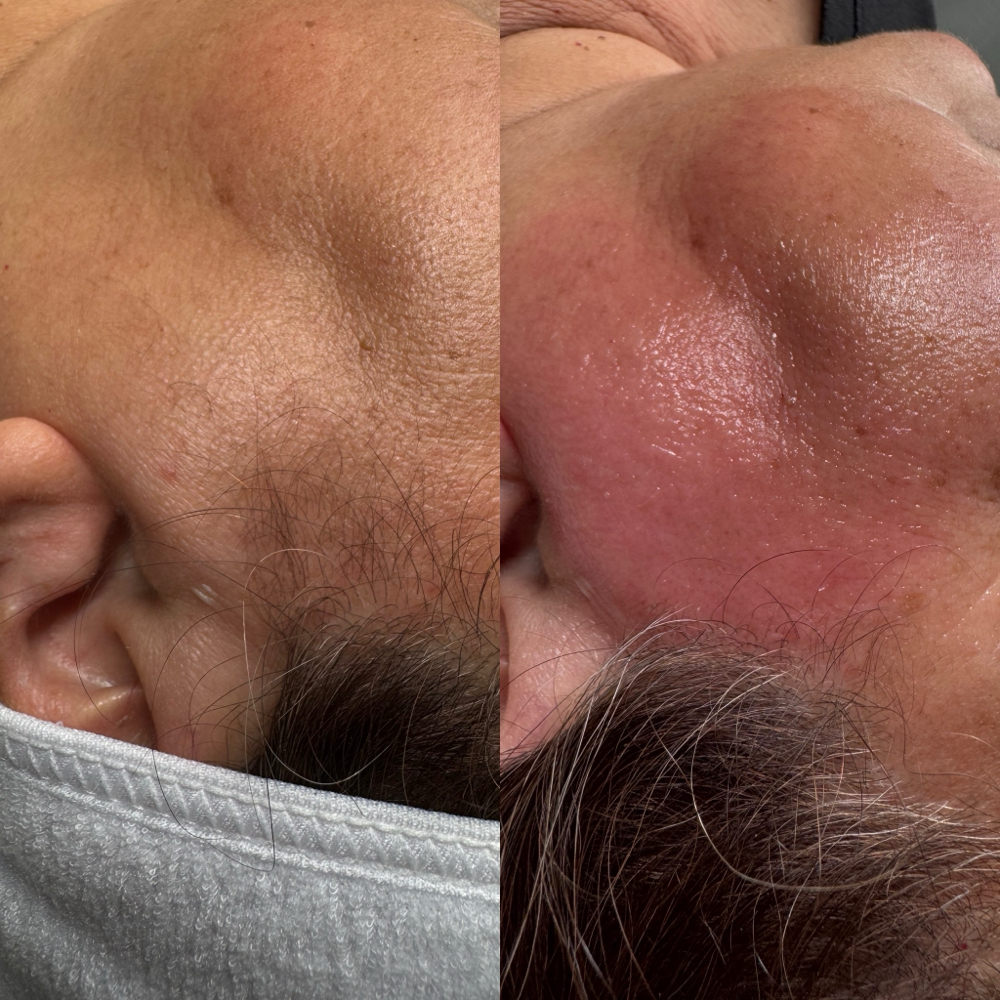 Cheeks Wax at Aesthetically You in Bakersfield, CA