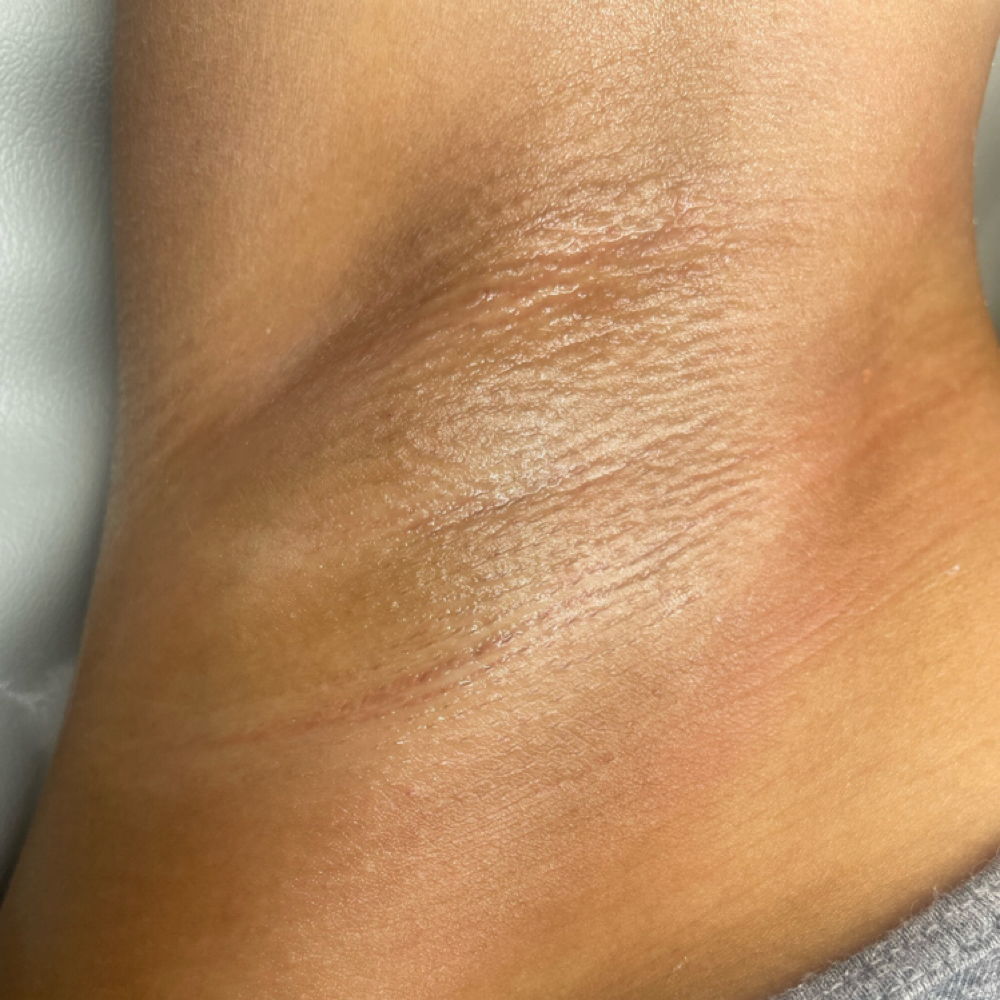 Brazilian + Free Underarm at ALL GLOWN UP SKINCARE in Temple Hills, MD