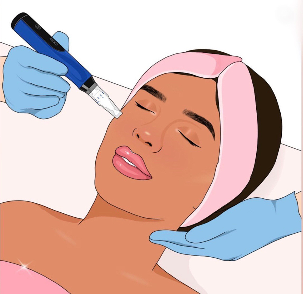 Diamond Dermabrasion Facial