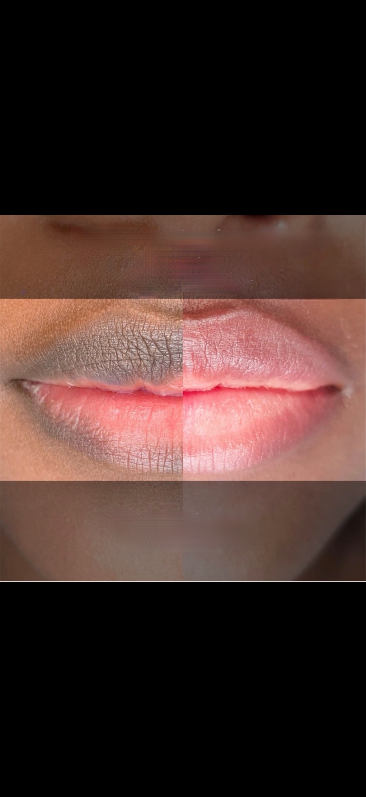 Lip Neutralization