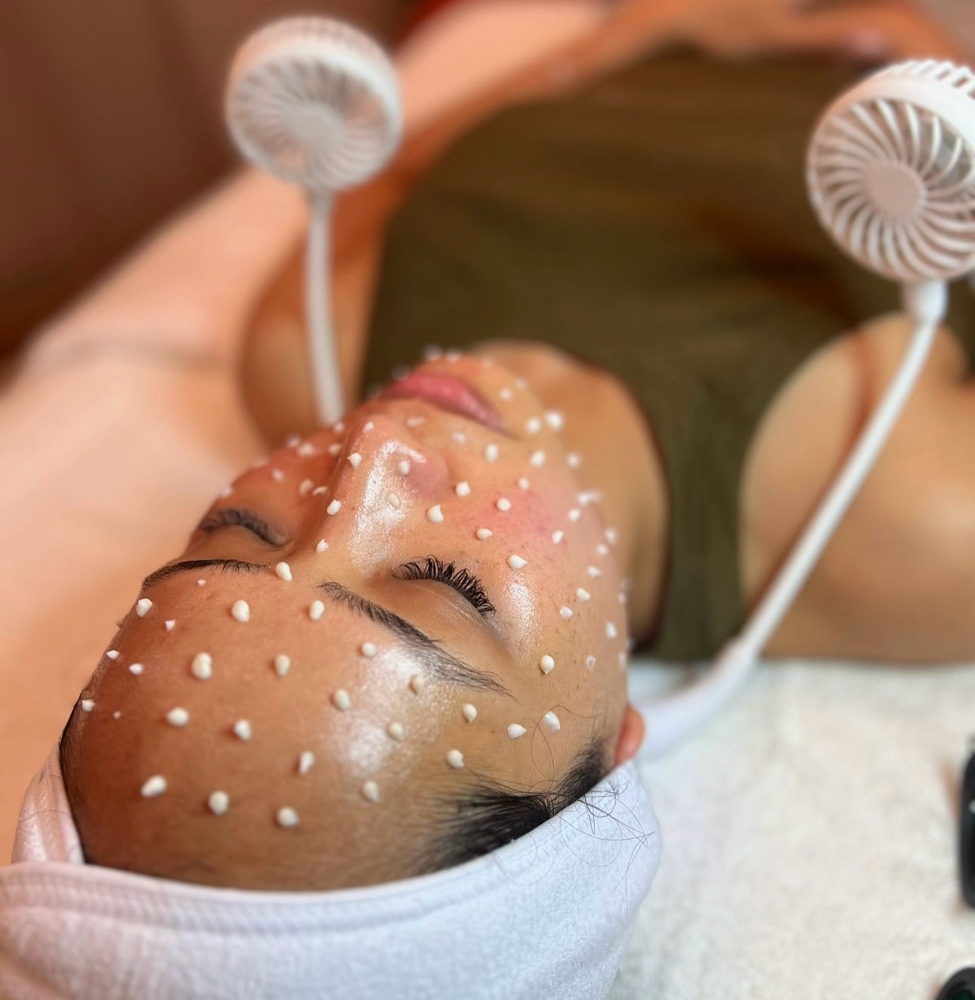 Liquid Microneedling +Celluma Light