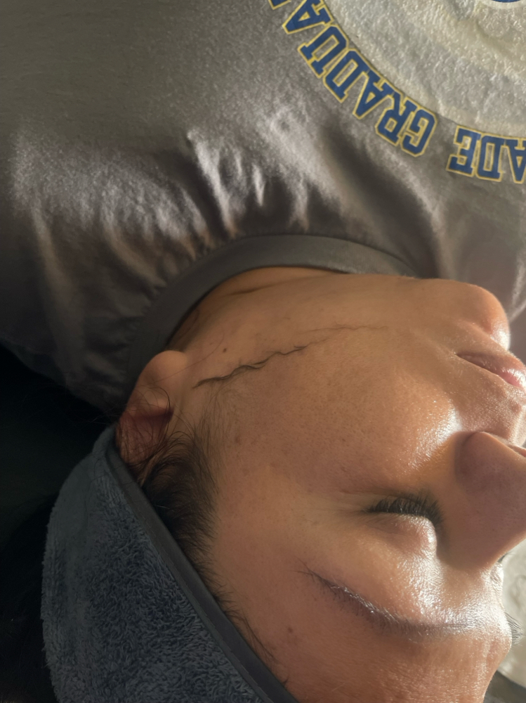 Dermaplaning Facial