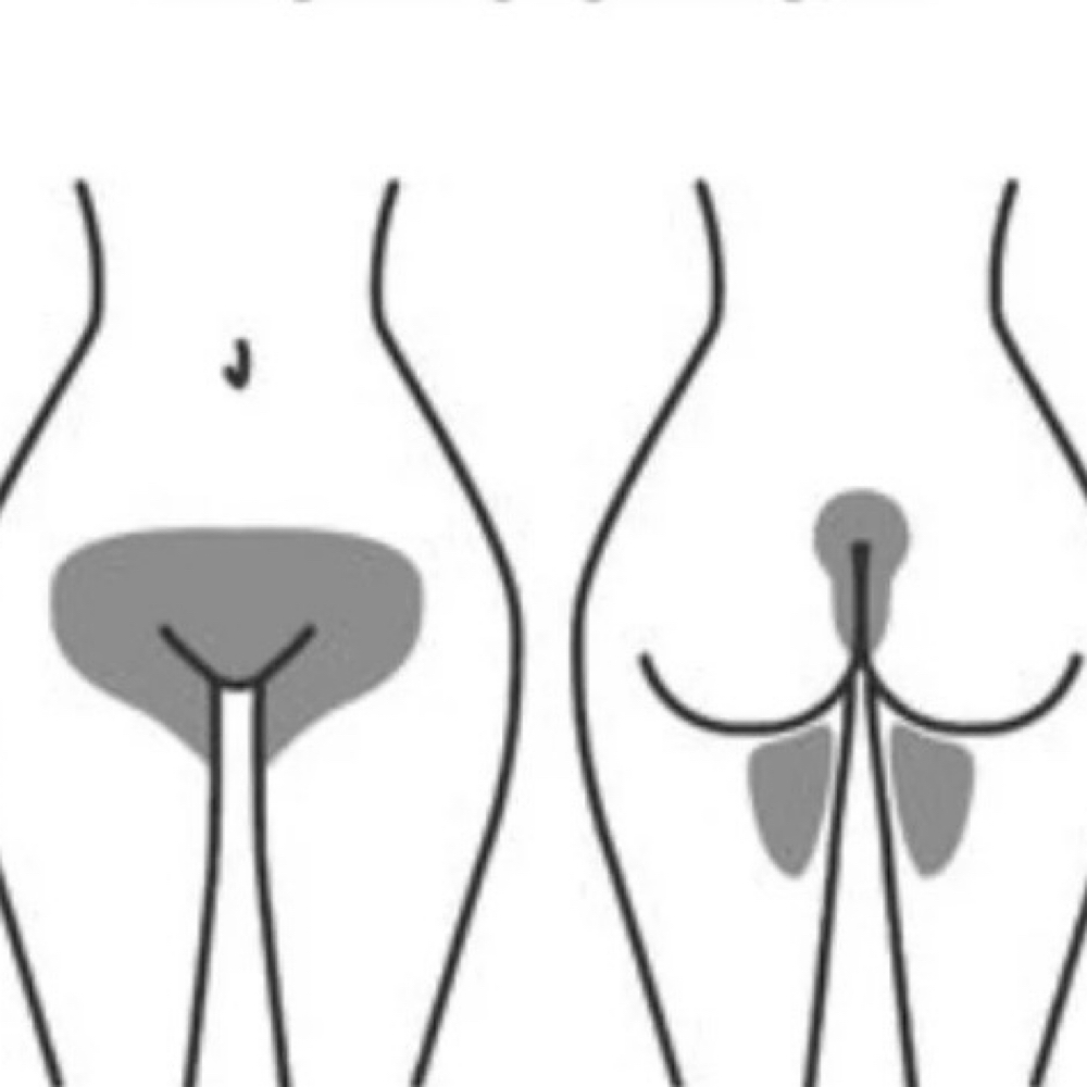 Women’s Brazilian at Any body and everybody waxing studio LLC in Fairborn, OH